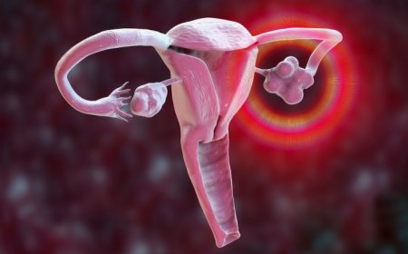 A malaria drug could be used to treat PCOS, a common hormone disorder