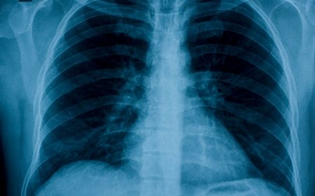 AI could take medical imaging to the next level 