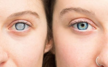 Do Cataracts Re-develop After Surgery? Are They More Common in Men or Women? 7 FAQs Answered