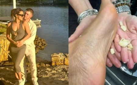 Priyanka Chopra’s Home Remedy to Rub Garlic Cloves on Her Foot Goes Viral But Does it Really Help? Here is What We Know