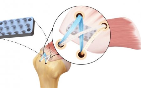 This python-inspired device could make rotator cuff surgeries more effective