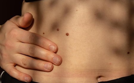 What is Melanoma? 5 Symptoms That Signal This Deadly Skin Cancer