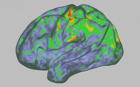 Psilocybin temporarily dissolves brain networks