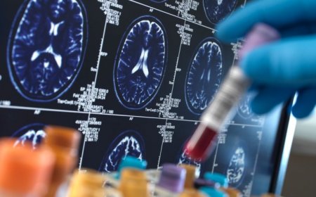 Alzheimer’s blood tests are getting better, but still have a ways to go