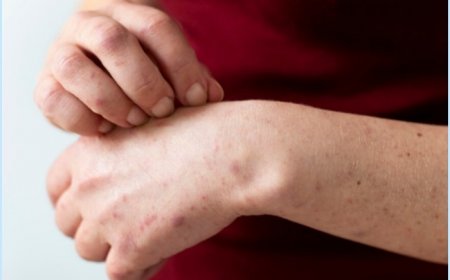 Mpox Health Emergency: Should India Be Worried? Mini Toolkit to Protect Yourself From Viral Disease