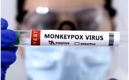 Monkeypox Alert In Pakistan: Airports On High Alert After First Case Detected