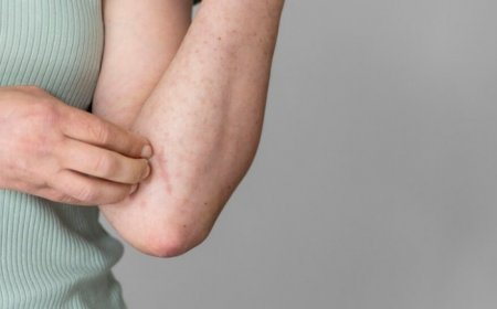 Mpox Outbreak: Can The Virus Spread Via Droplets in Air? Here is What We Know