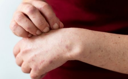 Mpox New Variant: All You Need to Know About ‘Deadlier’ Clade 1b Strain Detected in Thailand