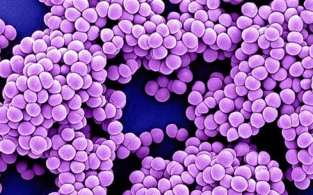 50 years ago, antibiotic resistant bacteria became a problem outside hospitals