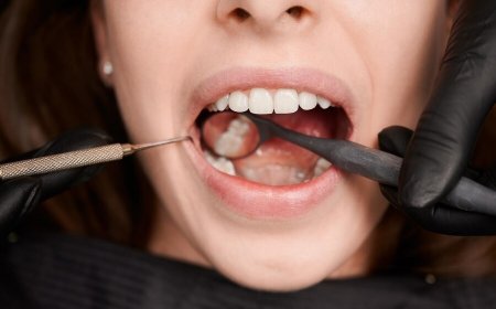 What Happens to Your Tooth Nerves When Cavities Strike? Symptoms And Prevention