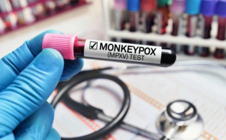 Monkey Pox Scare: Centre Asks States, UTs To Ensure Preparedness As 1st Mpox Positive Case Confirmed In India