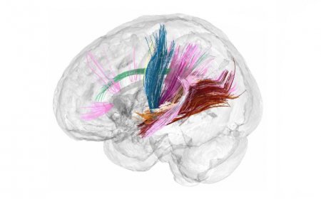 Pregnancy overhauls the brain. Here’s what that looks like