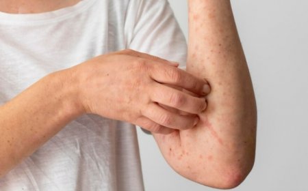 Mpox Clade 1 case in India: 5 Essential things to note and lower risk of infection