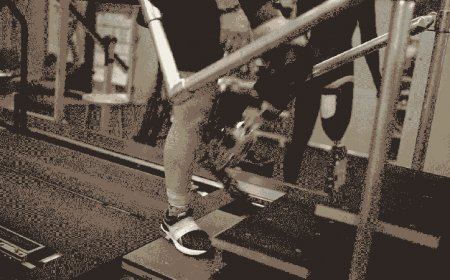 Brain-controlled bionic limbs are inching closer to reality