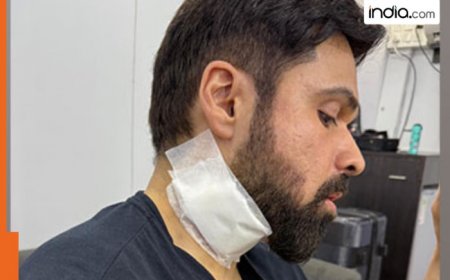 Emraan Hashmi gets injured during ‘Goodachari 2’ action sequence