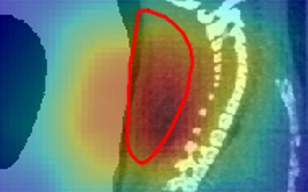 Radioactive beams give a real-time view of cancer treatment in mice